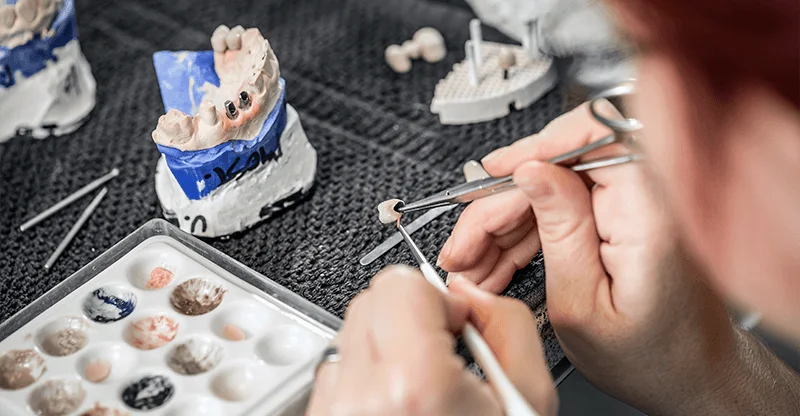 dental technician making veneers in a lab