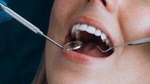 dentist consulting with a patient about composite bonding